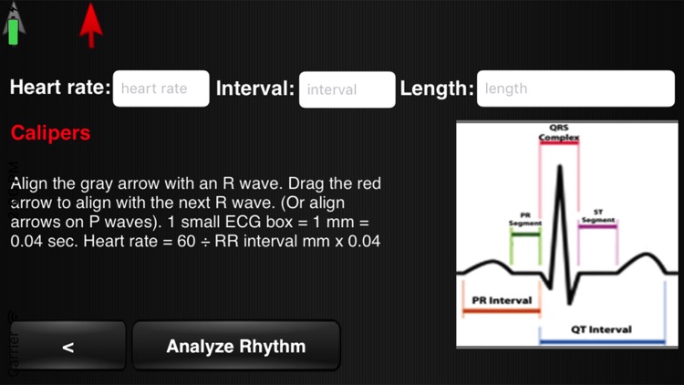 ECG Interpreter