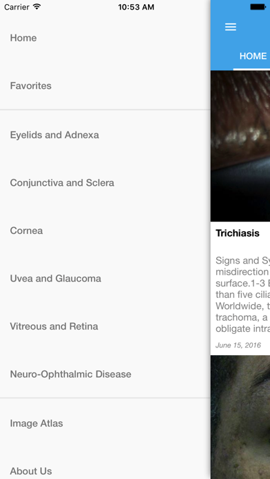 Screenshot #3 pour Ocular Disease Handbook