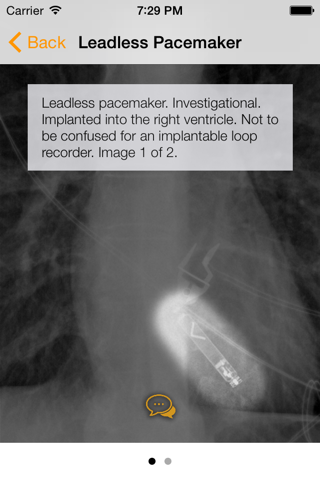 Medical Devices on Chest X-Ray - náhled