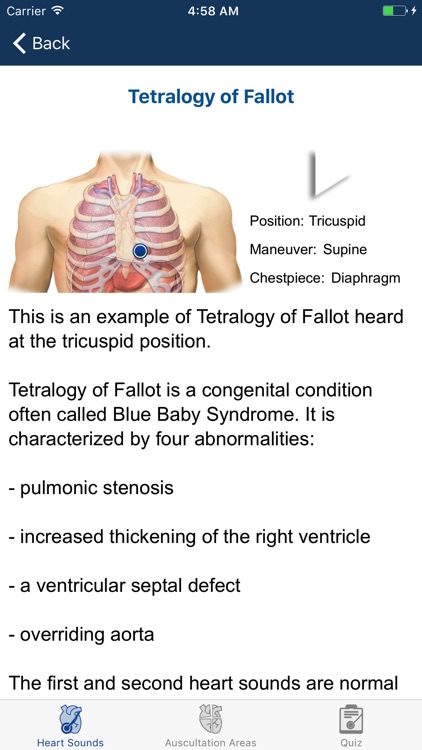 Heart Sounds Auscultation & Quiz screenshot-3