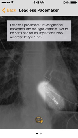 Medical Devices on Chest X-Rayのおすすめ画像1