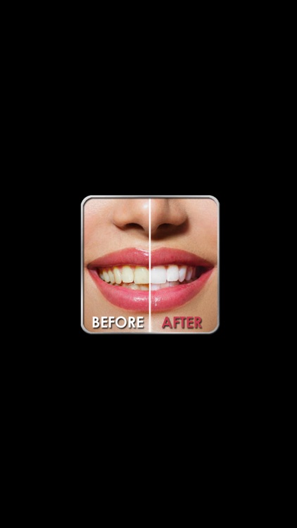 How To Whiten Your Teeth - At Home