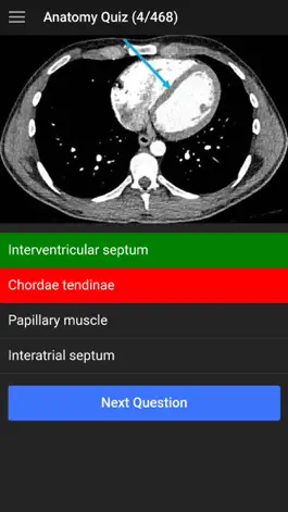 Game screenshot UBC Radiology hack