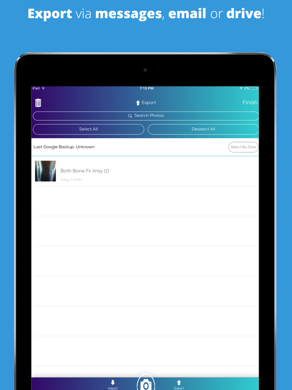 SurgiVision iPad screenshot 4 - Photo & Video app