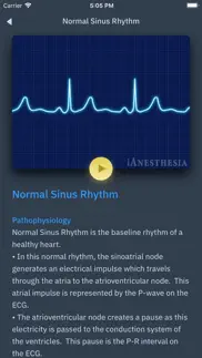 acls rhythms and quiz iphone resimleri 4