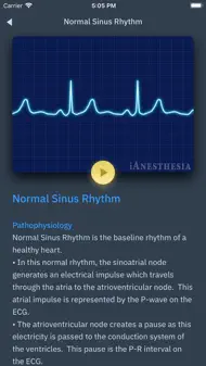 ACLS Rhythms and Quiz iphone bilder 3