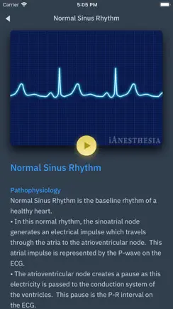 ACLS Rhythms and Quiz iPhone image 4