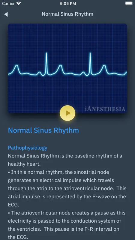 ACLS Rhythms and Quiz screenshot 4 of 5