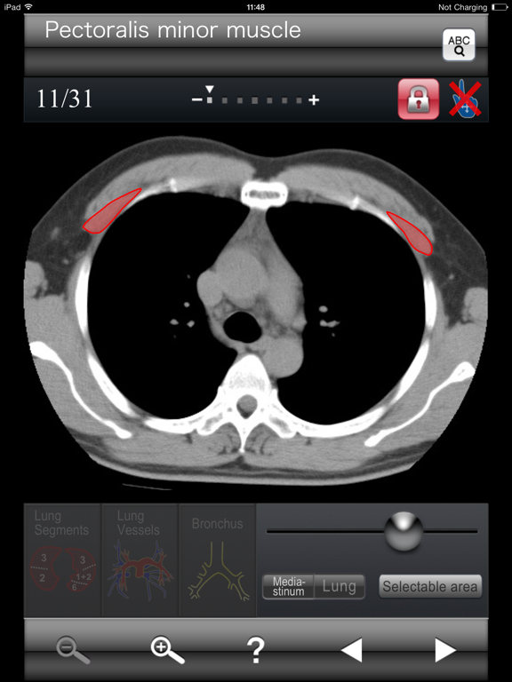Screenshot #6 pour Chest CT Sectional Walker