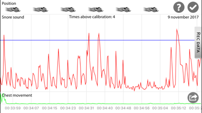 SnoreMonitorSleepLab Screenshot 3
