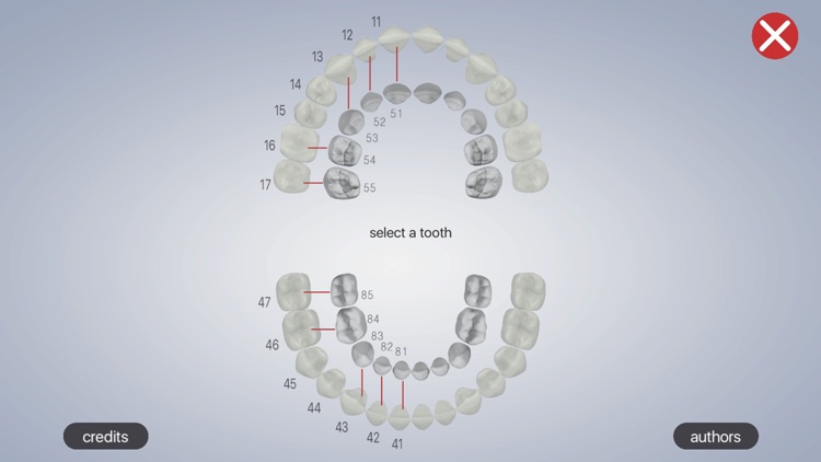 Dental Corpus Primary