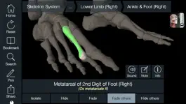 Game screenshot Essential Skeleton 4 hack