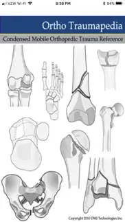 ortho traumapedia iphone screenshot 1