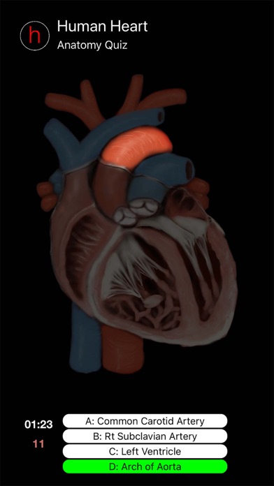 Human Heart Anatomy Quiz screenshot 2