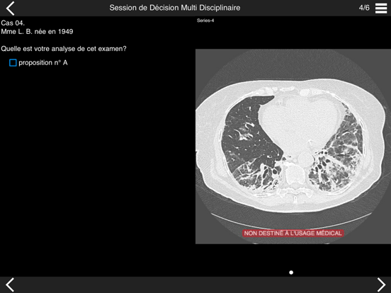 Screenshot #5 pour Fibrose pulmonaire 2017