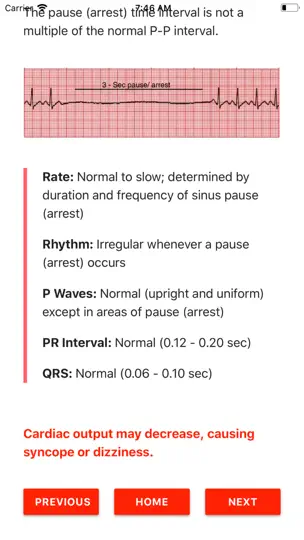 ECG FlashCards iPhone Screenshot 2