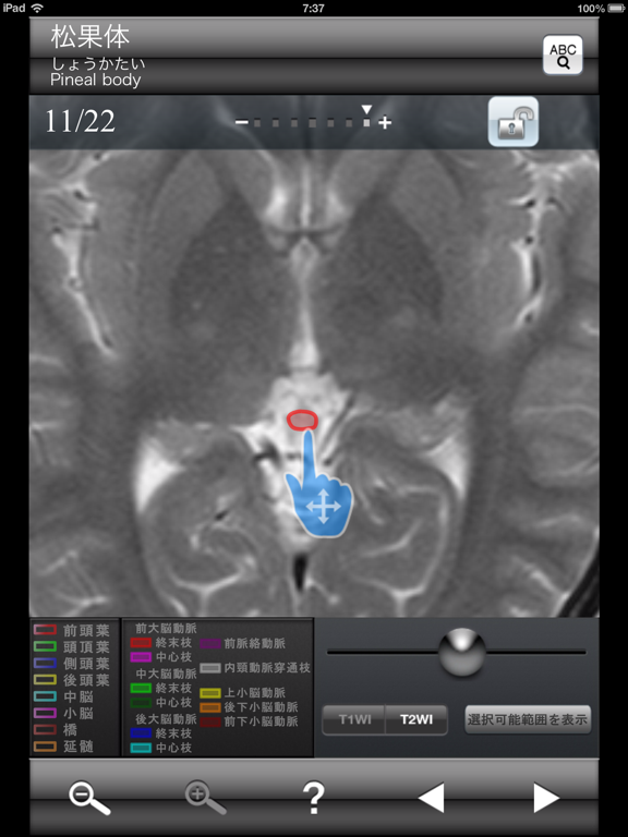Screenshot #4 pour 断面図ウォーカー脳MRI