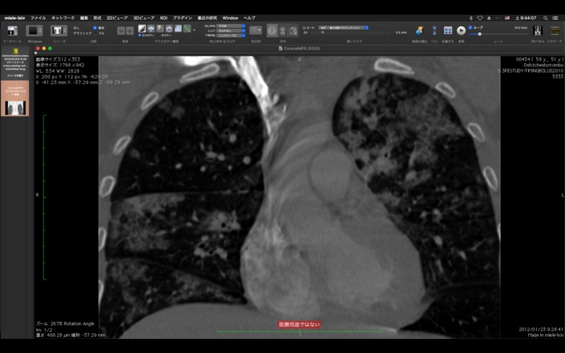 Osiri-LXIV DICOM viewer screenshot1