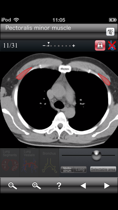 Chest CT Sectional Walkerのおすすめ画像4