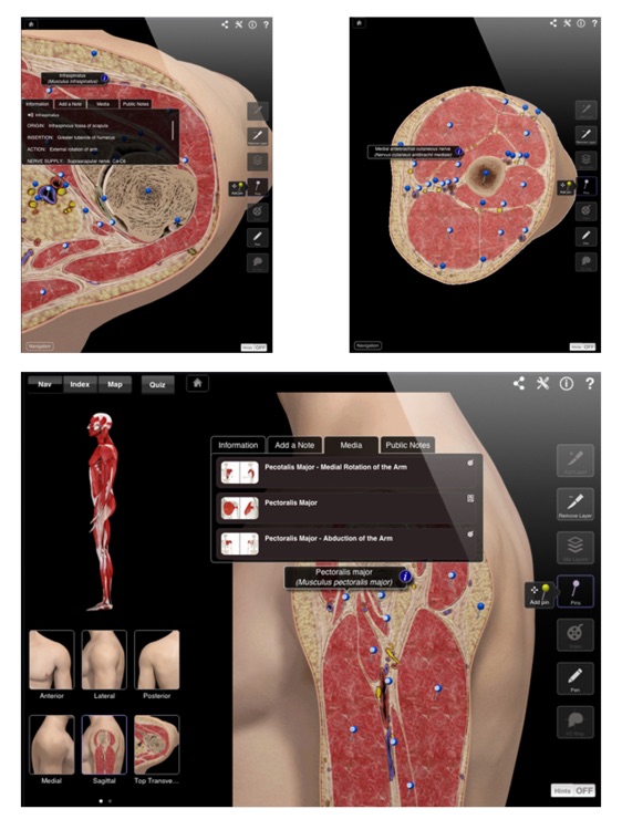 Shoulder Pro III for iPad