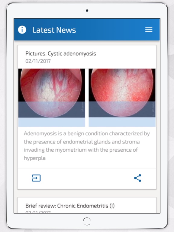 Screenshot #4 pour Hysteroscopy News