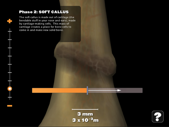 Powers of Minus Ten - Bone iPad screenshot 5 - Education app