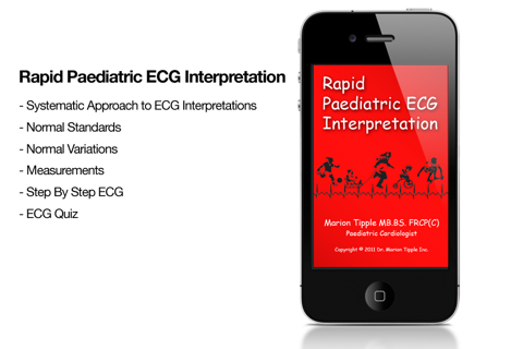 Rapid Paed ECG - náhled