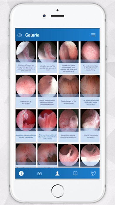 Screenshot #2 pour Hysteroscopy News