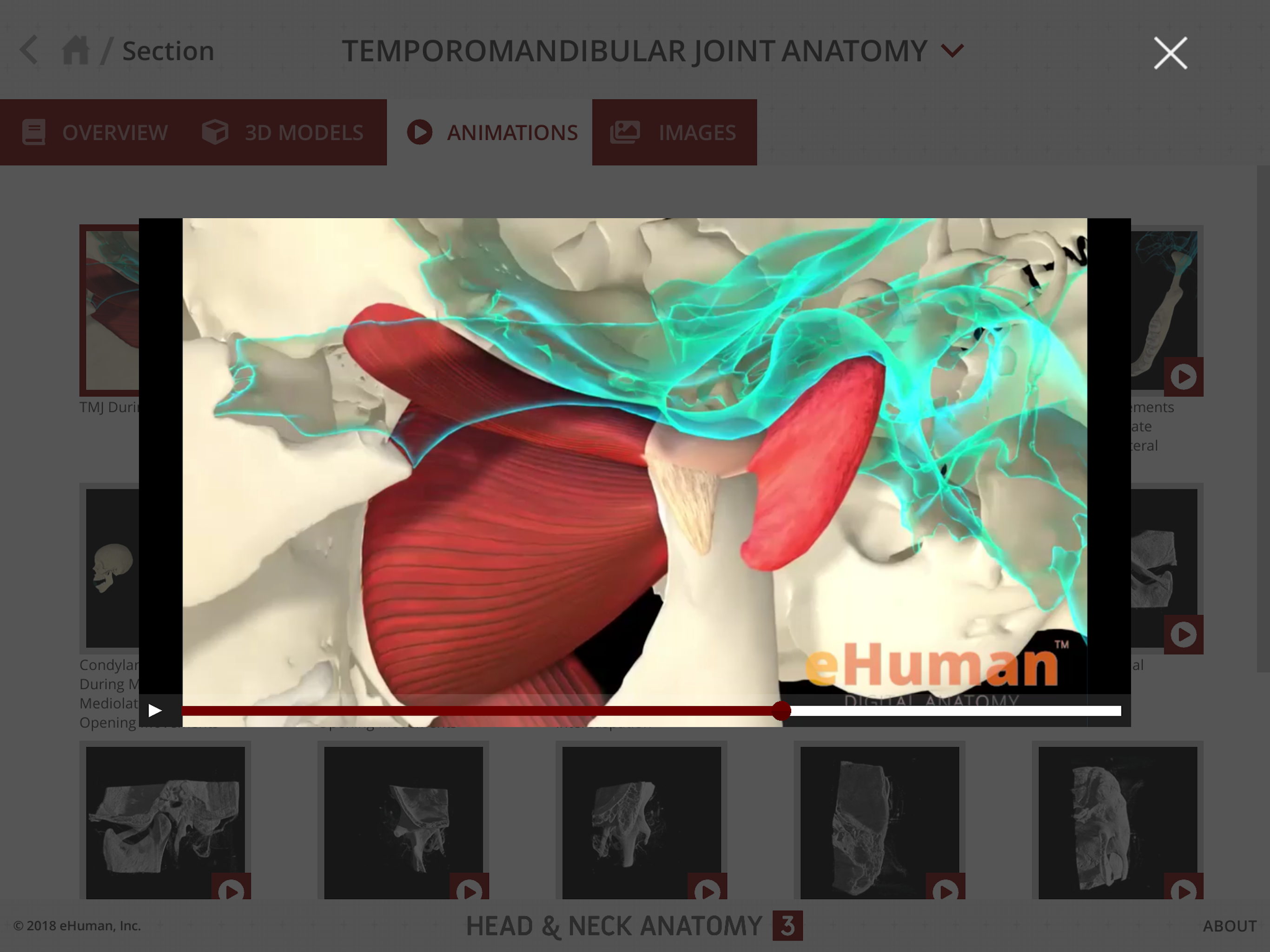 Head and Neck Anatomy 3 screenshot 8