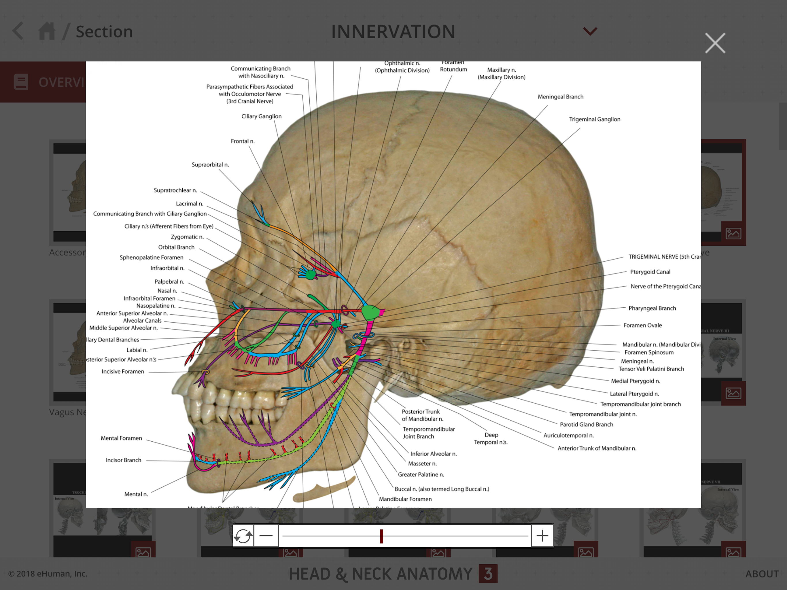 Head and Neck Anatomy 3 screenshot 10