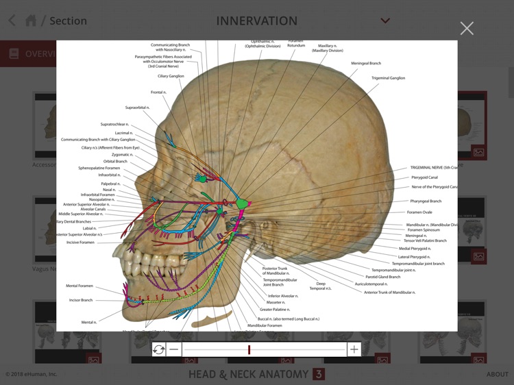 Head and Neck Anatomy 3 screenshot-9