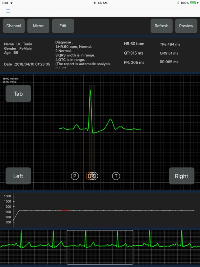 WeCardio Pro(圖4)-速報App