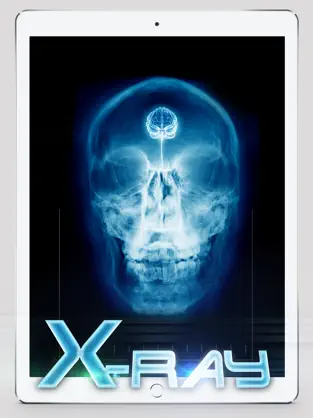 Screenshot 4 Best X-Ray iphone