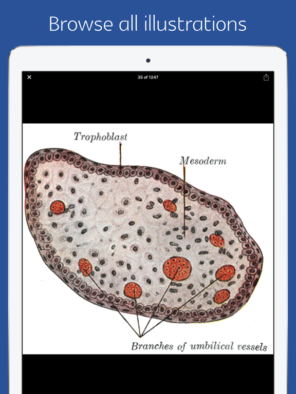Anatomy of Human Body - audio iPad screenshot