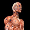 Trigger Points Myofasciaux