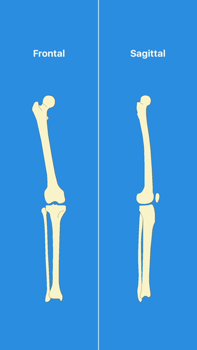 OsteoGauge - lower limb Screenshot