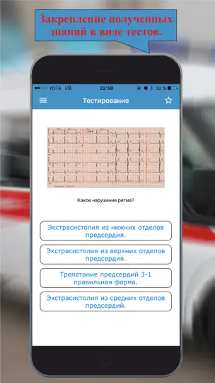Скриншот ЭКГ: Расшифровка и тесты. на iPhone 3