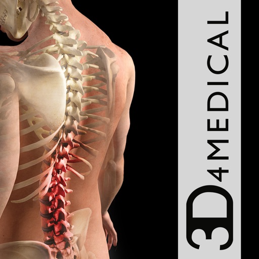 Get Orthopedic Patient Education for iOS, iPhone, iPad Aso Report