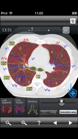 Game screenshot Chest CT Sectional Walker apk