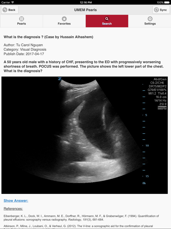 Screenshot #4 pour UMEM Pearls