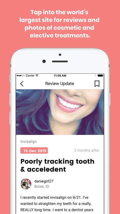 RealSelf: Treatments & Reviews