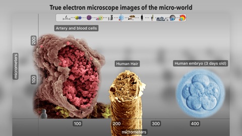 Screenshot #16 for Universal Zoom