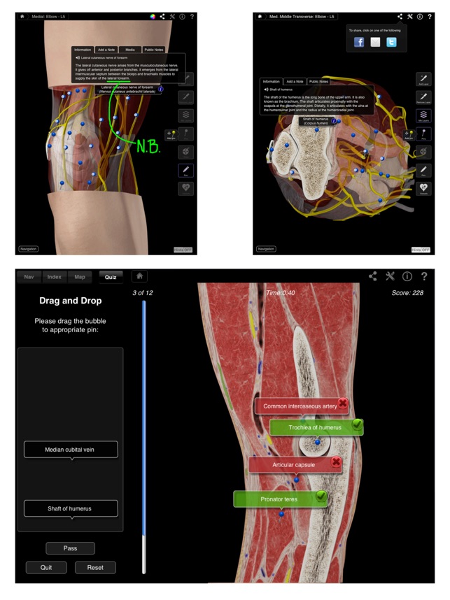 Elbow Pro III for iPad(圖3)-速報App