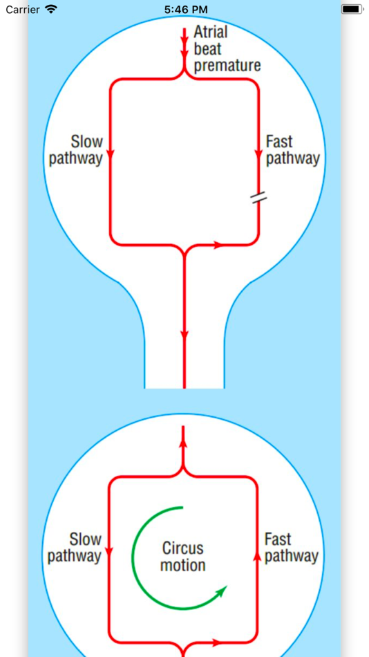 #3. ECG Basics Lite: ECG Made Easy (iOS) Bởi: Sree Hari Reddy Gadekallu