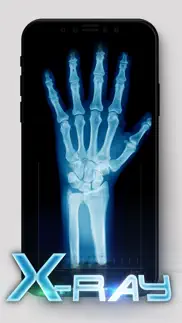 best x-ray iphone screenshot 3