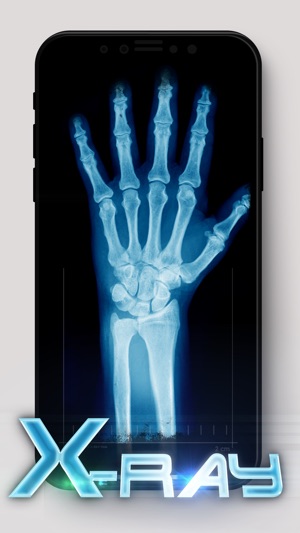 Best X-Ray on the App Store