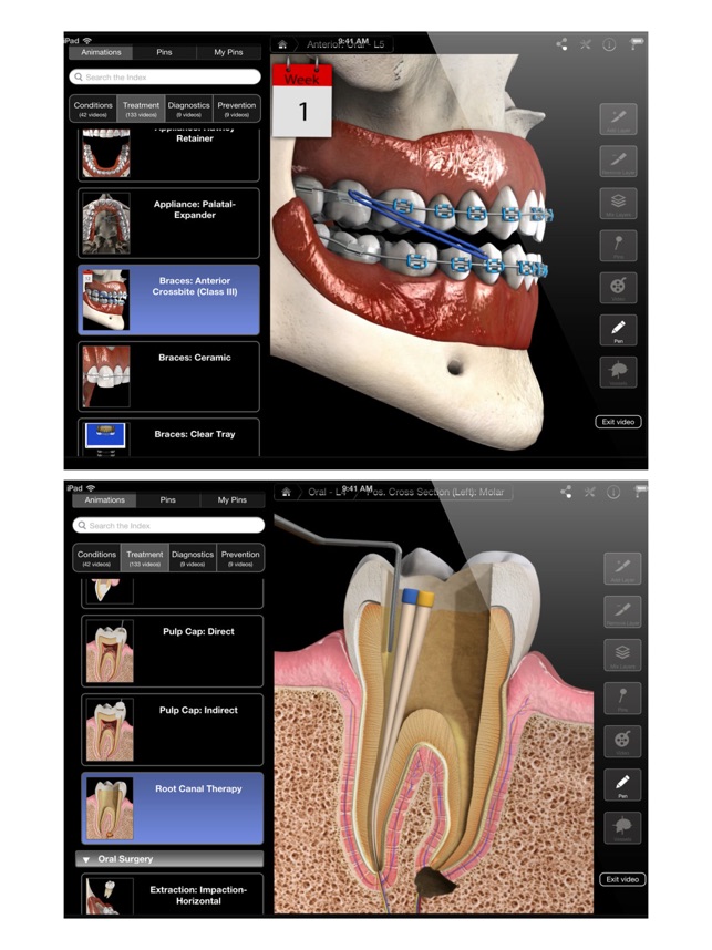 Dental Patient Education(圖5)-速報App