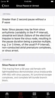 ecgsource iphone resimleri 1