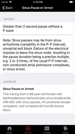 ECGsource iPhone image 1