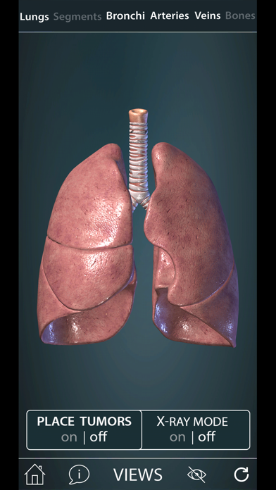 Surgical Anatomy of the Lung Screenshot